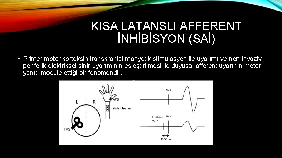 KISA LATANSLI AFFERENT İNHİBİSYON (SAİ) • Primer motor korteksin transkranial manyetik stimulasyon ile uyarımı