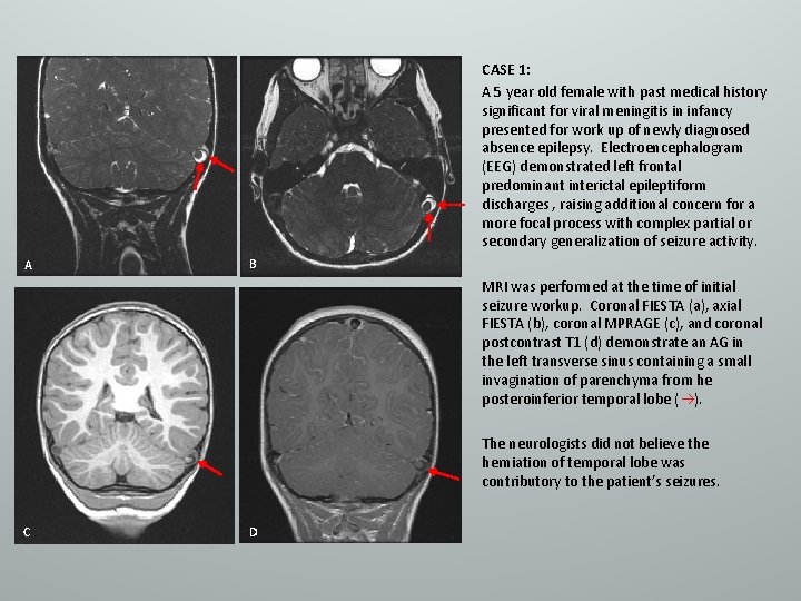 CASE 1: A 5 year old female with past medical history significant for viral