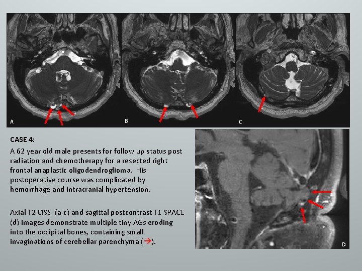 A B C CASE 4: A 62 year old male presents for follow up