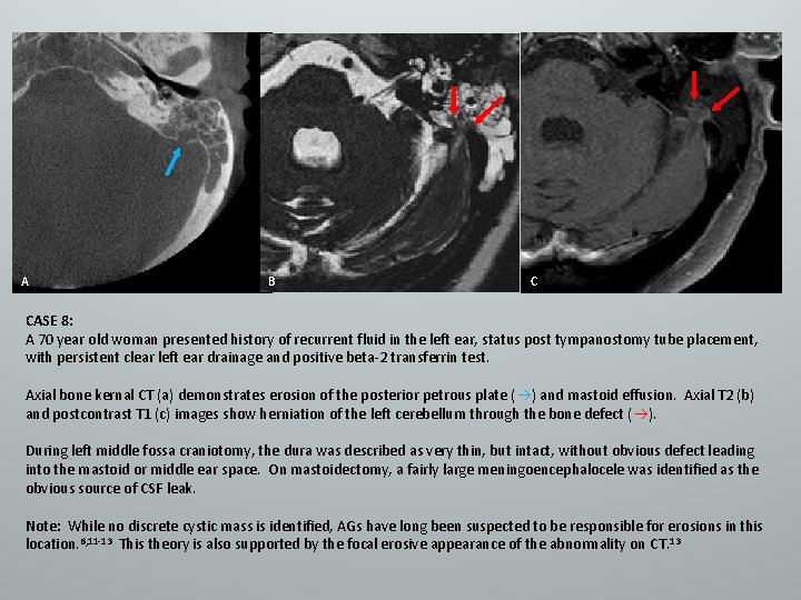 A B C CASE 8: A 70 year old woman presented history of recurrent