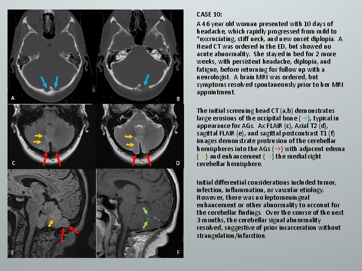 A C B D CASE 10: A 46 year old woman presented with 10