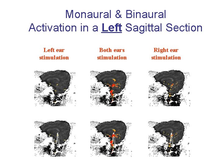 Monaural & Binaural Activation in a Left Sagittal Section Left ear stimulation Both ears