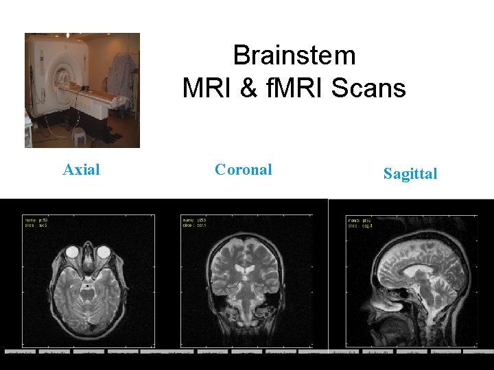 Brainstem MRI & f. MRI Scans Axial Coronal Sagittal 