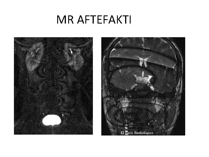 MR AFTEFAKTI 