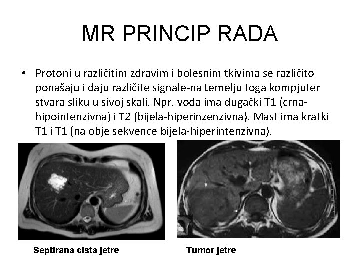 MR PRINCIP RADA • Protoni u različitim zdravim i bolesnim tkivima se različito ponašaju