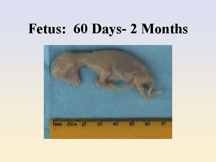 Fetus: 60 Days- 2 Months 