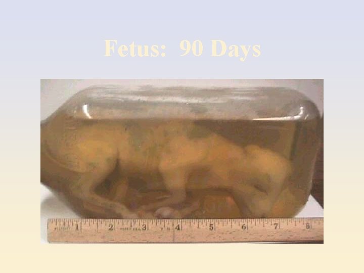 Fetus: 90 Days 