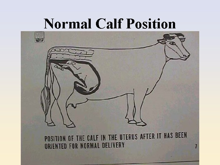 Normal Calf Position 