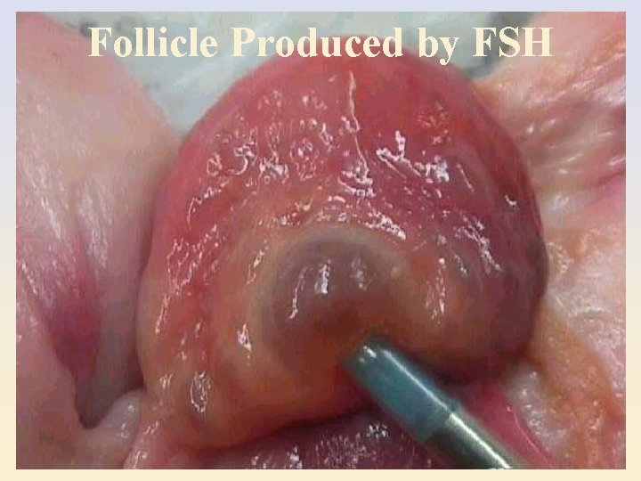 Follicle Produced by FSH 