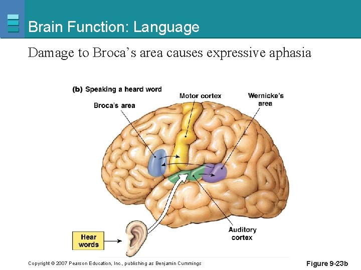Brain Function: Language Damage to Broca’s area causes expressive aphasia Copyright © 2007 Pearson