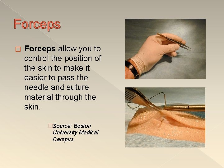 Forceps � Forceps allow you to control the position of the skin to make