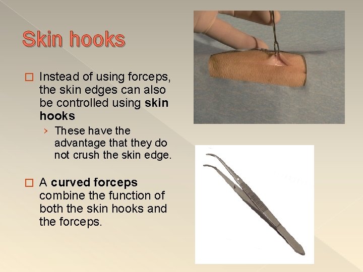 Skin hooks � Instead of using forceps, the skin edges can also be controlled
