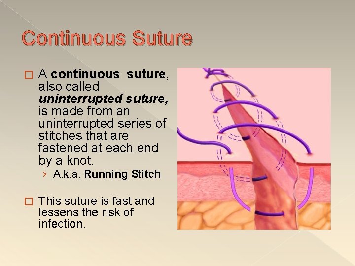 Continuous Suture � A continuous suture, also called uninterrupted suture, is made from an