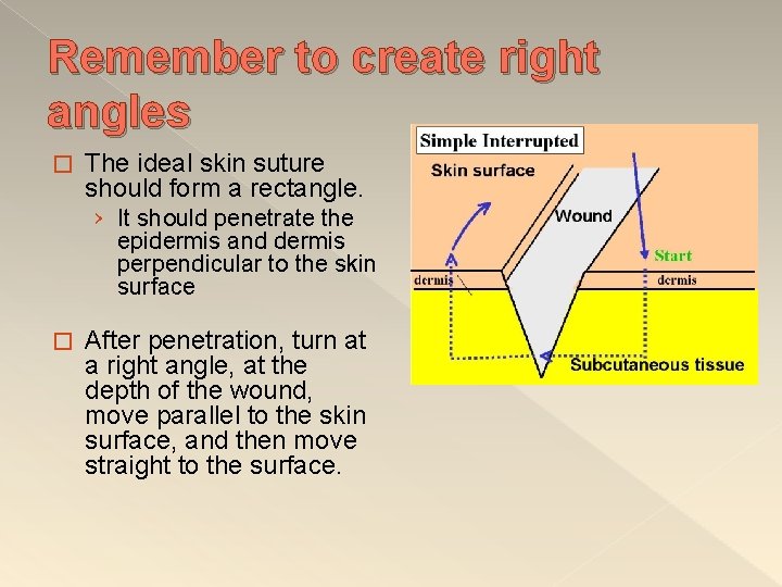Remember to create right angles � The ideal skin suture should form a rectangle.