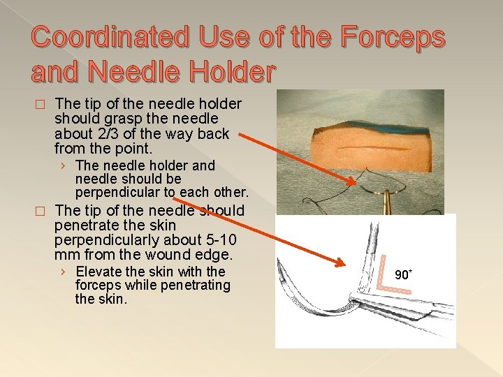 Coordinated Use of the Forceps and Needle Holder � The tip of the needle