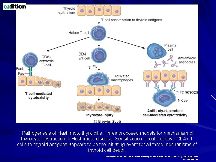 Pathogenesis of Hashimoto thyroiditis. Three proposed models for mechanism of thyrocyte destruction in Hashimoto