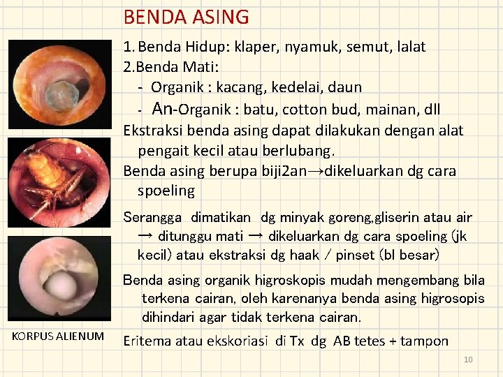 BENDA ASING 1. Benda Hidup: klaper, nyamuk, semut, lalat 2. Benda Mati: - Organik