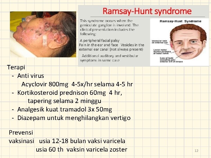 Terapi - Anti virus Acyclovir 800 mg 4 -5 x/hr selama 4 -5 hr