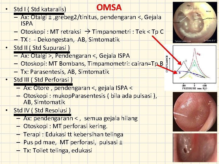 OMSA • Std I ( Std kataralis) – Ax: Otalgi ± , grebeg 2/tinitus,