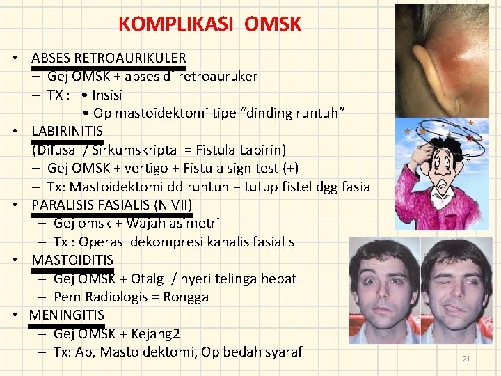 KOMPLIKASI OMSK • ABSES RETROAURIKULER – Gej OMSK + abses di retroauruker – TX