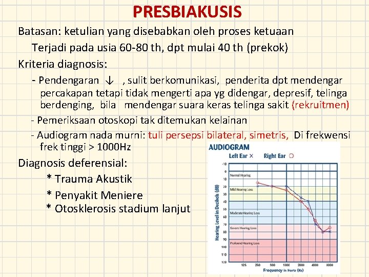 PRESBIAKUSIS Batasan: ketulian yang disebabkan oleh proses ketuaan Terjadi pada usia 60 -80 th,