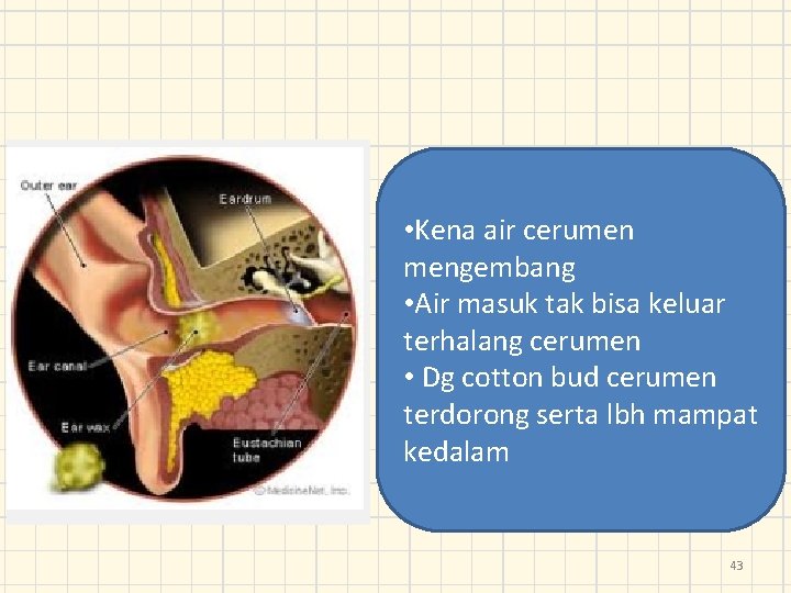  • Kena air cerumen mengembang • Air masuk tak bisa keluar terhalang cerumen