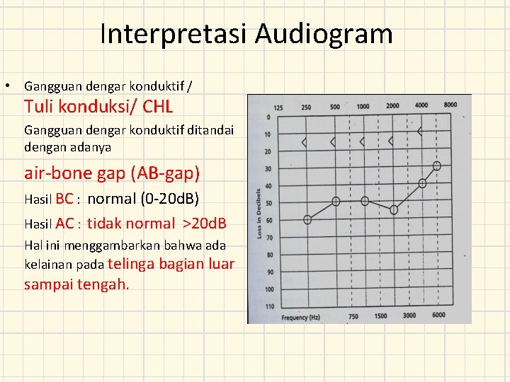 Interpretasi Audiogram • Gangguan dengar konduktif / Tuli konduksi/ CHL Gangguan dengar konduktif ditandai