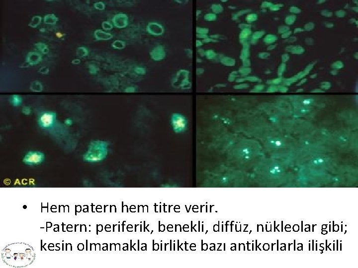  • Hem patern hem titre verir. -Patern: periferik, benekli, diffüz, nükleolar gibi; kesin