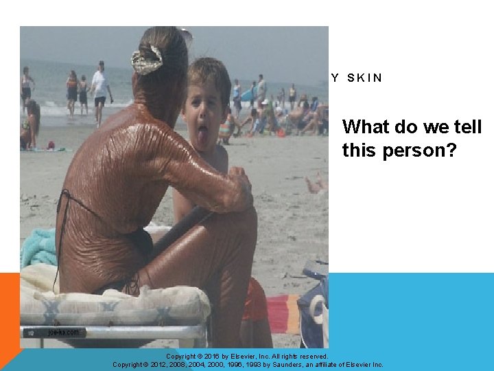 LEATHERY SKIN What do we tell this person? Copyright © 2016 by Elsevier, Inc.