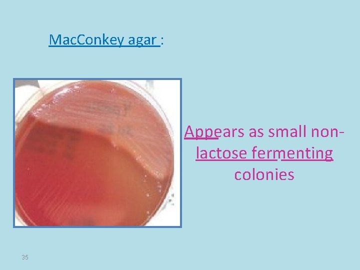 Mac. Conkey agar : Appears as small nonlactose fermenting colonies 35 