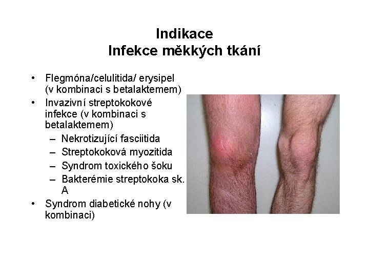 Indikace Infekce měkkých tkání • Flegmóna/celulitida/ erysipel (v kombinaci s betalaktemem) • Invazivní streptokokové