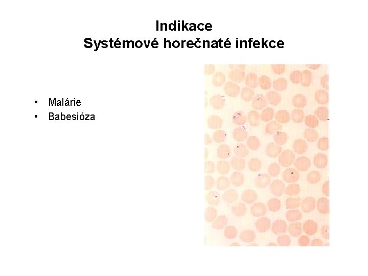 Indikace Systémové horečnaté infekce • Malárie • Babesióza 