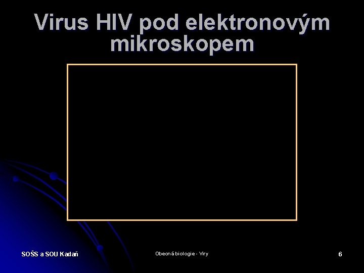 Virus HIV pod elektronovým mikroskopem SOŠS a SOU Kadaň Obecná biologie - Viry 6