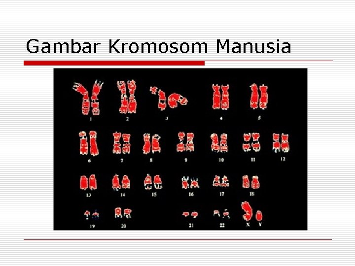 Gambar Kromosom Manusia 