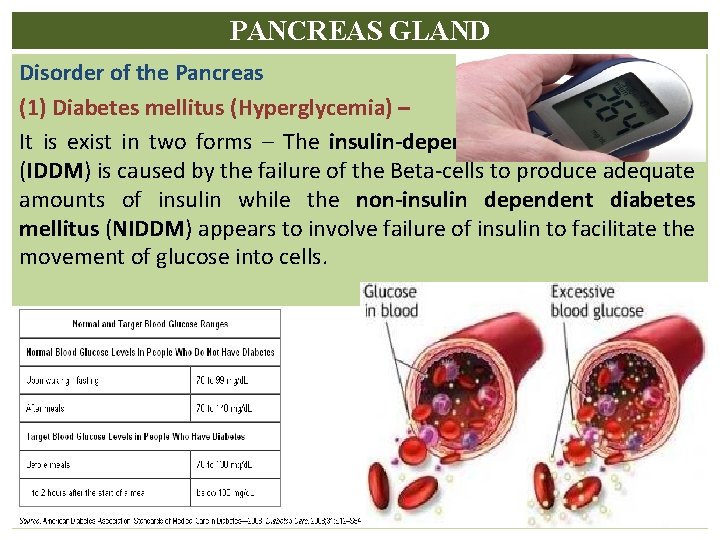 PANCREAS GLAND Disorder of the Pancreas (1) Diabetes mellitus (Hyperglycemia) – It is exist