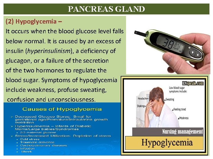 PANCREAS GLAND (2) Hypoglycemia – It occurs when the blood glucose level falls below