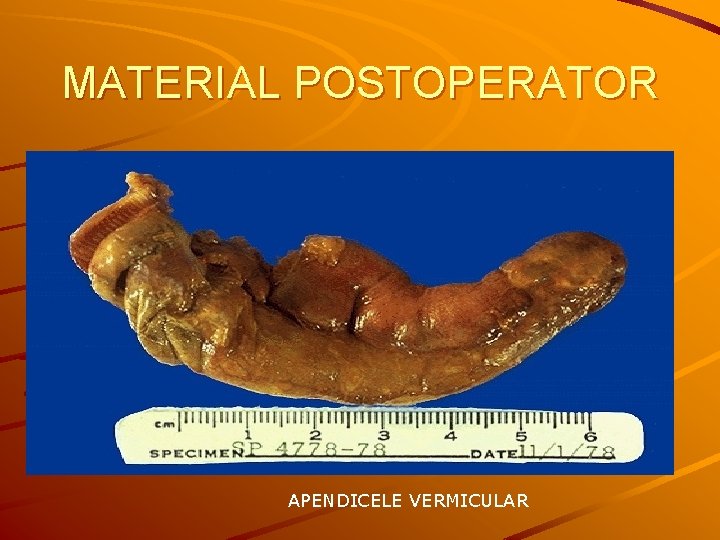 MATERIAL POSTOPERATOR APENDICELE VERMICULAR 