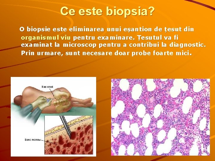 Ce este biopsia? O biopsie este eliminarea unui eșantion de țesut din organismul viu