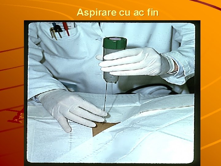 Aspirare cu ac fin 