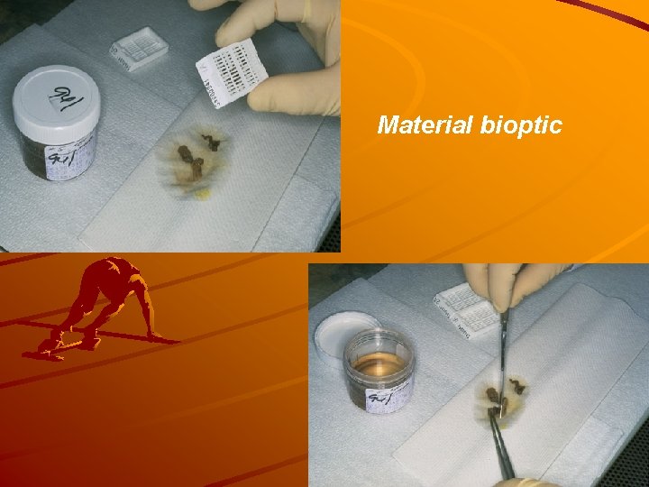 Material bioptic 