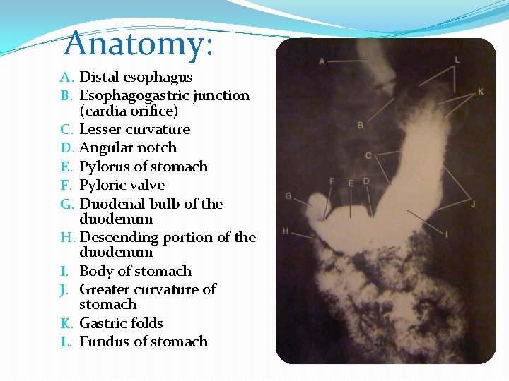 Anatomy: A. Distal esophagus B. Esophagogastric junction (cardia orifice) C. Lesser curvature D. Angular