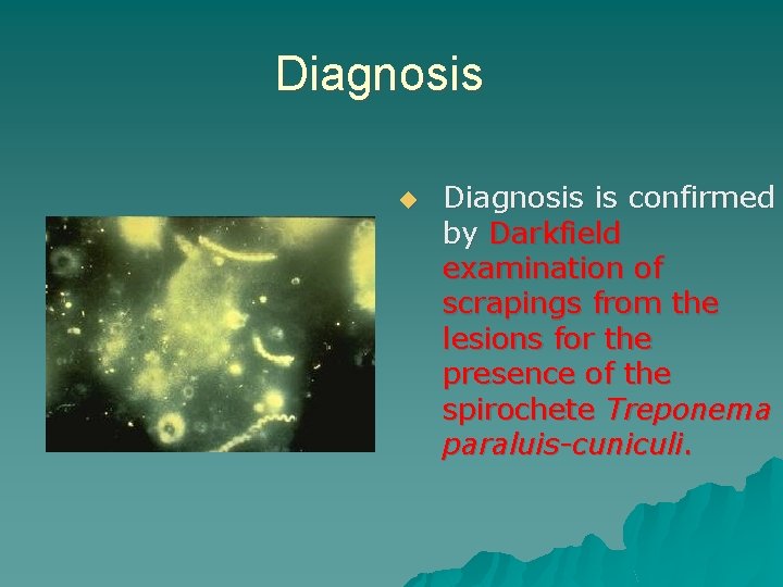 Diagnosis ◆ Diagnosis is confirmed by Darkfield examination of scrapings from the lesions for