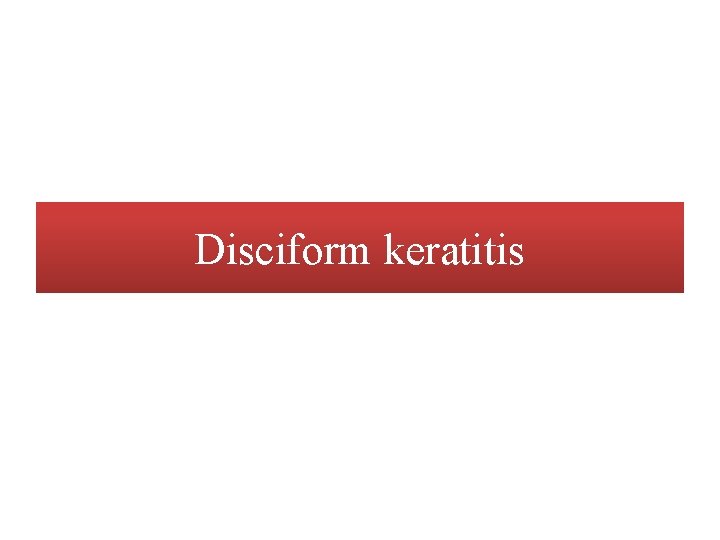Disciform keratitis 