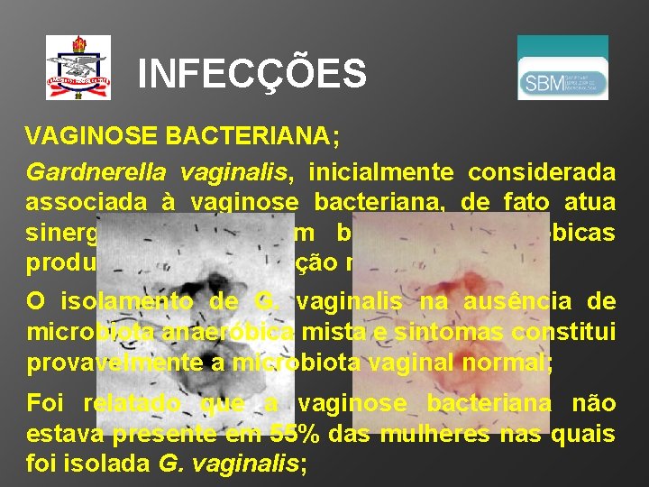 INFECÇÕES VAGINOSE BACTERIANA; Gardnerella vaginalis, inicialmente considerada associada à vaginose bacteriana, de fato atua