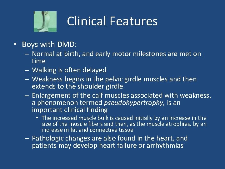Clinical Features • Boys with DMD: – Normal at birth, and early motor milestones