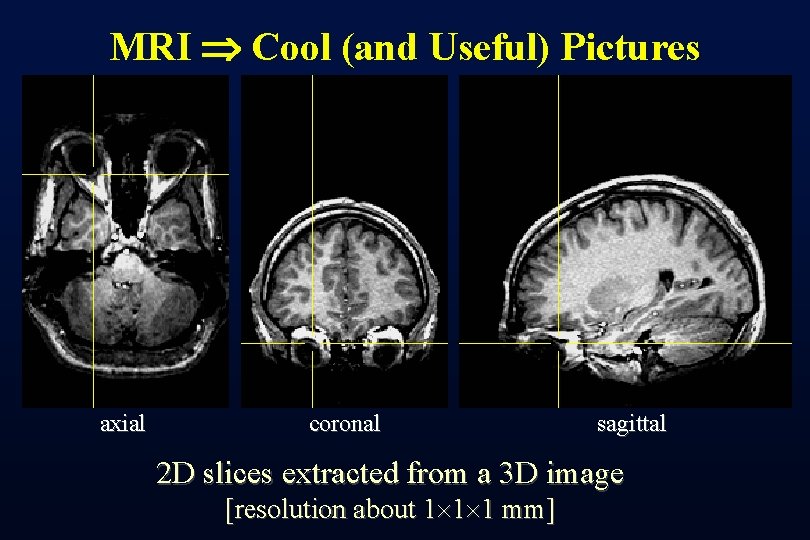 MRI Cool (and Useful) Pictures axial coronal sagittal 2 D slices extracted from a
