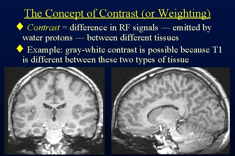 The Concept of Contrast (or Weighting) ¨ Contrast = difference in RF signals —