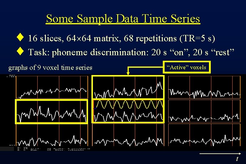 Some Sample Data Time Series ¨ 16 slices, 64 64 matrix, 68 repetitions (TR=5