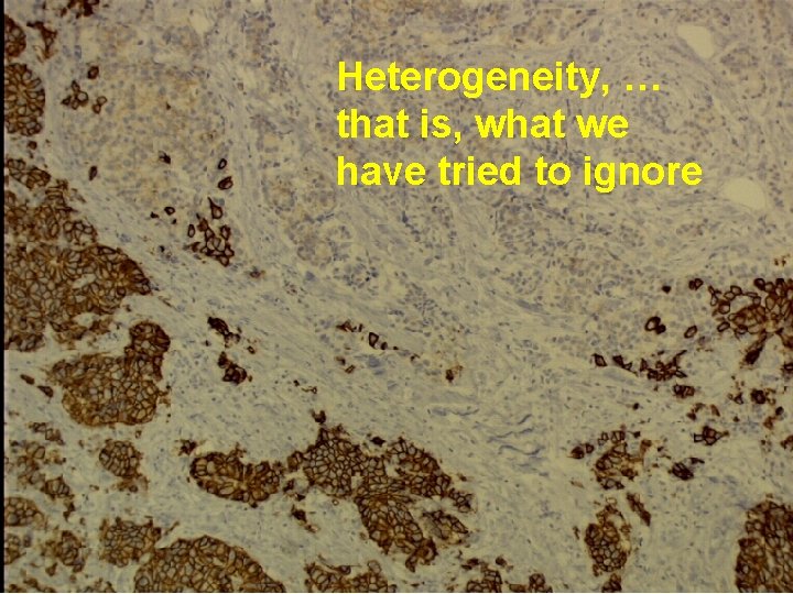 Heterogeneity, … that is, what we have tried to ignore 
