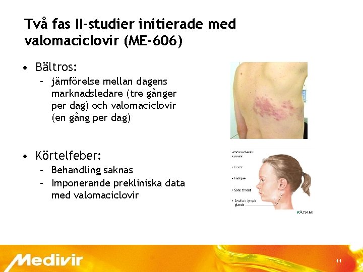 Två fas II-studier initierade med valomaciclovir (ME-606) • Bältros: – jämförelse mellan dagens marknadsledare